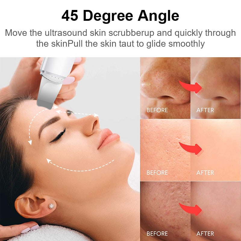 High-End Ultrasonic Cleansing for Flawless skin